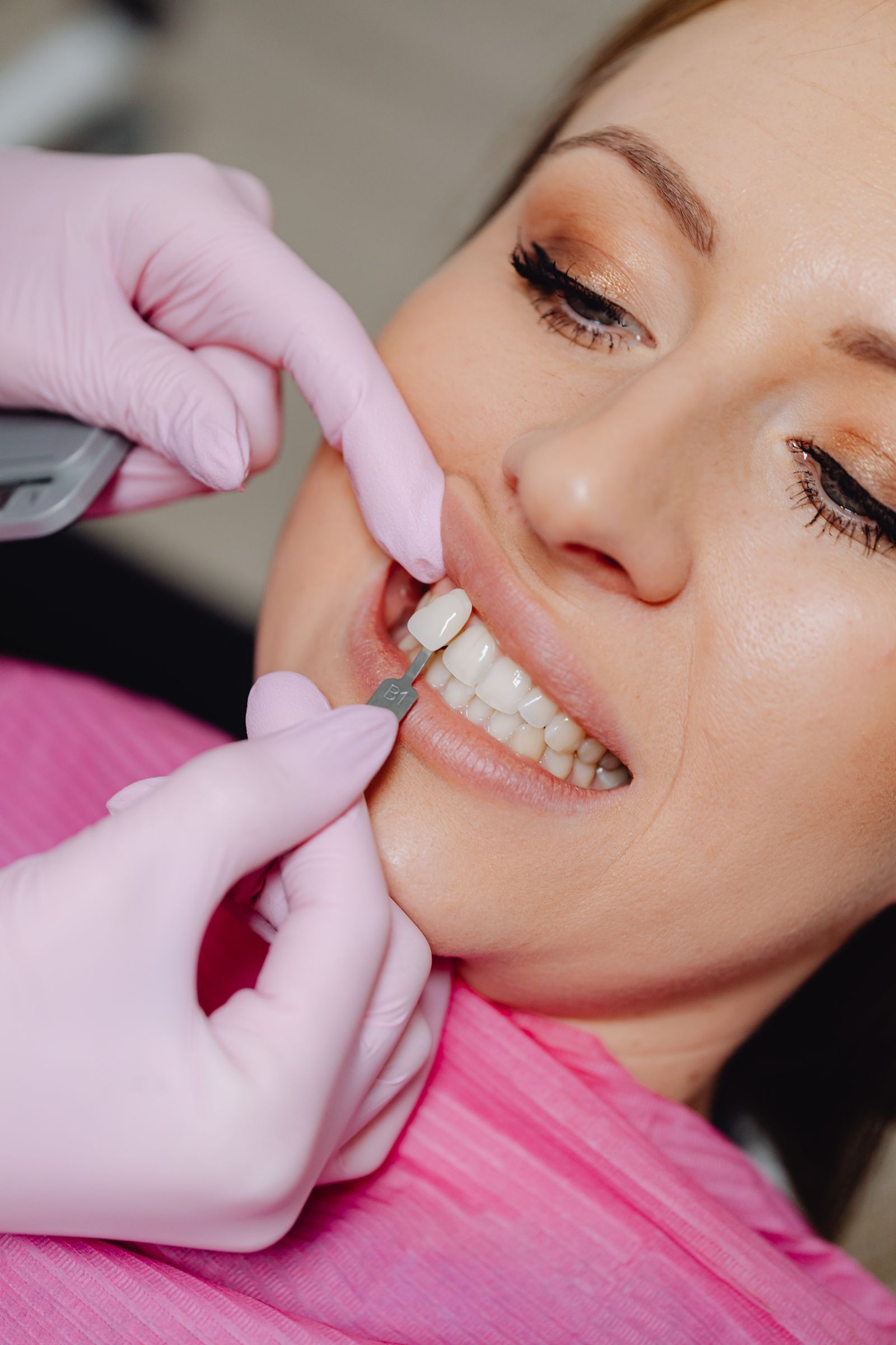 Selección del tono de los dientes para un tratamiento estético